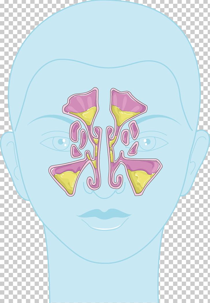 Nose Sinus Infection Child Chronic Condition Swelling PNG, Clipart,  Free PNG Download