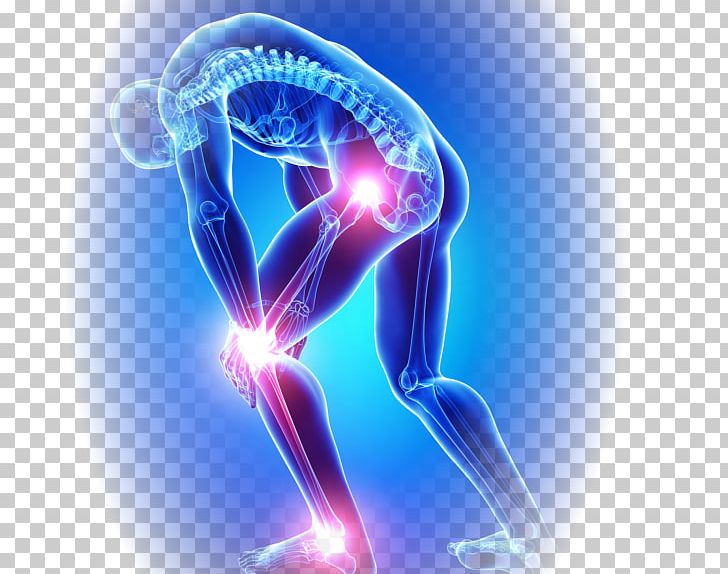 Knee Pain Joint Pain Osteoarthritis PNG, Clipart, Arthritis, Brain, Chiropractic, Computer Wallpaper, Energy Free PNG Download
