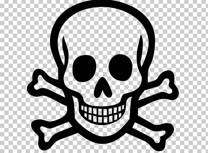 Poison Computer Icons Symbol Skull And Crossbones PNG, Clipart, Artwork, Black And White, Bone, Computer Icons, Crossbones Free PNG Download