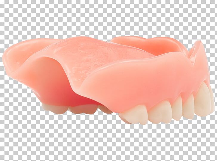 Dentures Jaw Aspen Dental Dentistry PNG, Clipart, Aspen Dental, Blog, Dentistry, Dentures, Digital Media Free PNG Download
