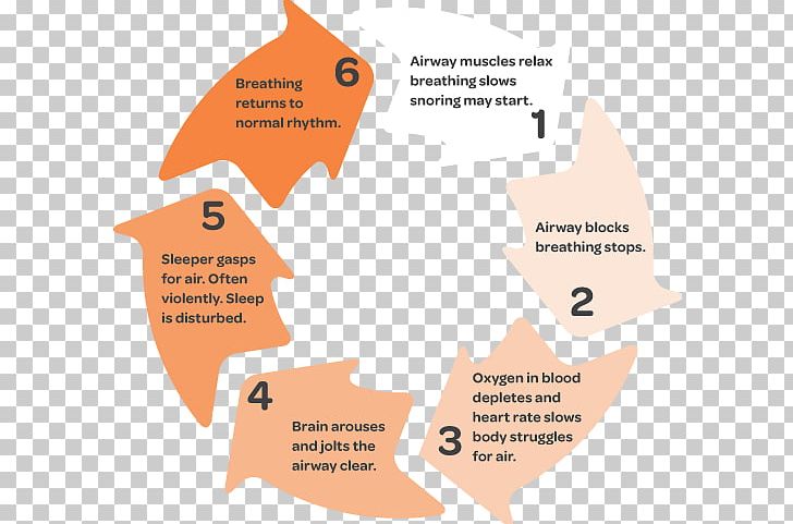Obstructive Sleep Apnea Breathing PNG, Clipart, Adverse Effect, Angle, Apnea, Area, Brand Free PNG Download