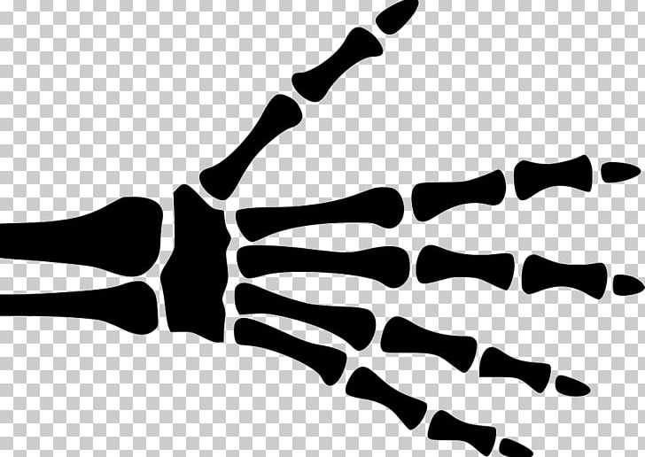 Finger X-ray Hand Carpal Bones PNG, Clipart, Black, Black And White, Bone, Carpal Bones, Computer Icons Free PNG Download
