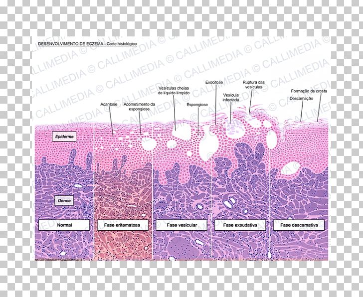 Histology Dermatitis Keratinocyte Microscope Slides Corte Histológico PNG, Clipart, Angle, Area, Biology, Brand, Cell Free PNG Download