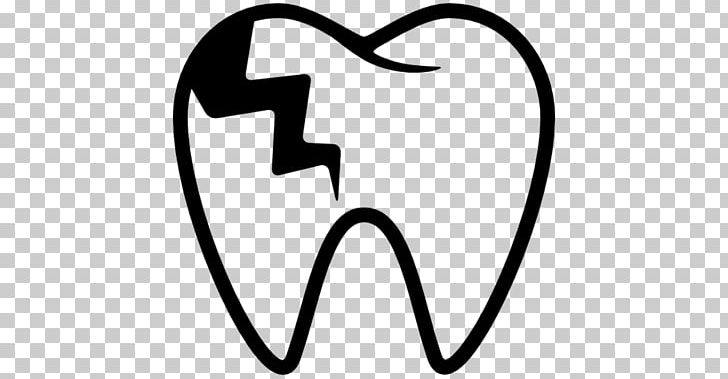 Tooth Decay Dentistry Human Tooth Computer Icons PNG, Clipart, Black And White, Crown, Dental Drill, Dental Implant, Dental Surgery Free PNG Download