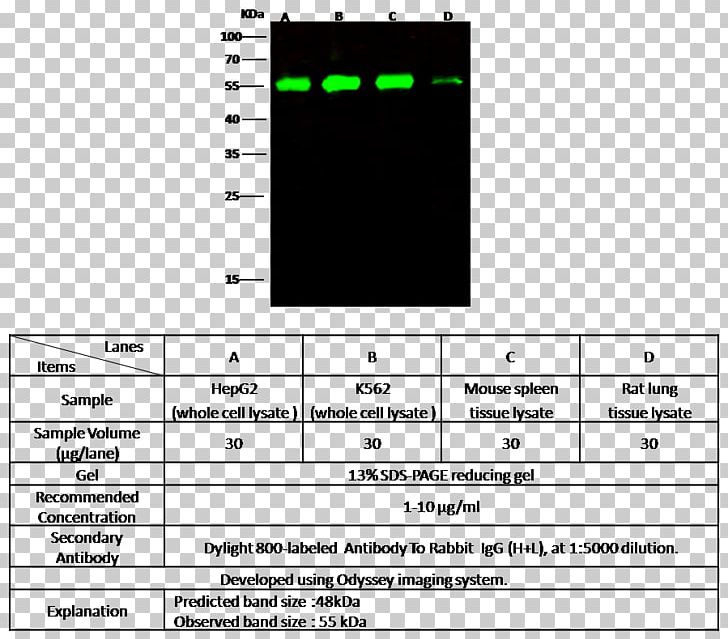 IL1B Interleukin-1 Family Western Blot ELISA Antibody PNG, Clipart, Abcam, Angle, Antibody, Area, Black Free PNG Download