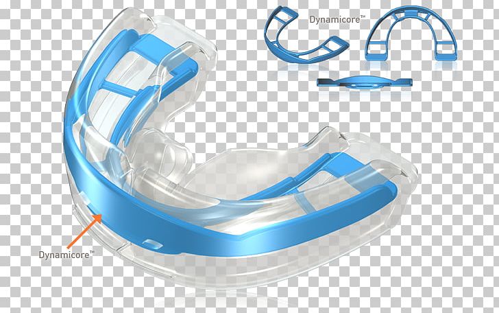 Splint Activator Orthodontics Dentistry Dental Braces Tooth PNG, Clipart, Angle, Artikel, Blue, Computer Software, Crown Free PNG Download