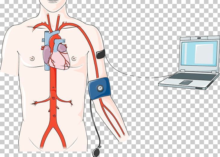 Nursing Care Plan Anatomy Circulatory System Shoulder PNG, Clipart, Abdomen, Abdominal Aortic Aneurysm, Anatomy, Aorta, Arm Free PNG Download