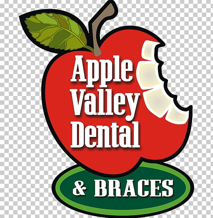 Apple Valley Eye Center Dentistry Apple Valley Dental & Braces PNG, Clipart, Apple Valley, Apple Valley Dental Braces, Apple Valley Eye Center, Area, Artwork Free PNG Download