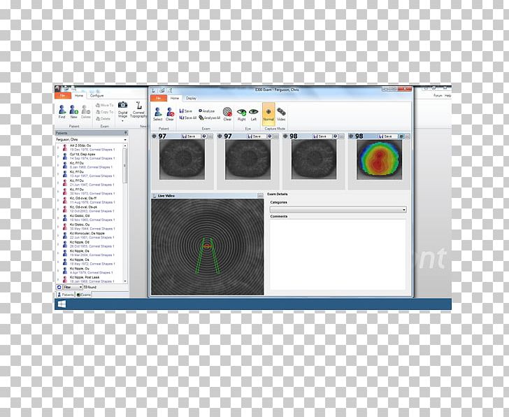 Corneal Topography Surveyor Computer Software Orthokeratology PNG, Clipart, Brand, Capture, Computer Software, Contact Lens, Contact Lenses Free PNG Download