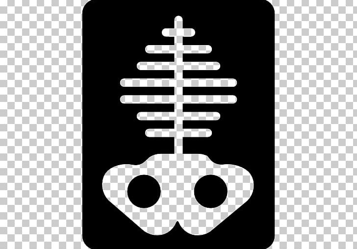 Bone X-ray Lung PNG, Clipart, Black And White, Bone, Chest Radiograph, Computer Icons, Fantasy Free PNG Download