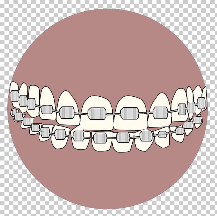 Tooth Whitening Velopex International Dental Abrasion Air-Polishing PNG, Clipart, Airpolishing, Cabinetry, Cheek, Chin, Cleaning Free PNG Download