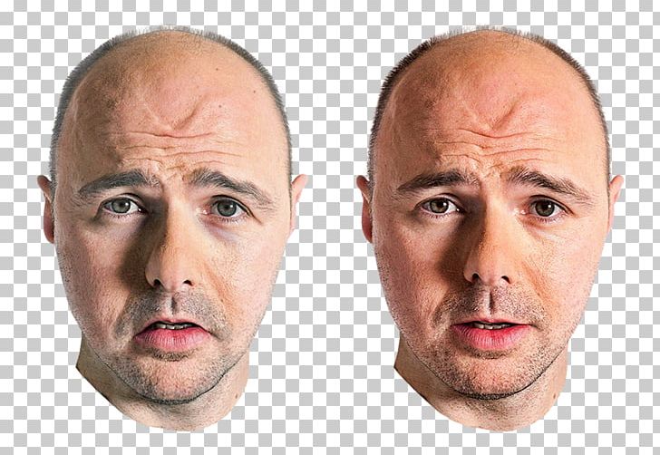 Karl Pilkington Nose Face Manchester PNG, Clipart, Cheek, Chin, Ear, Eyebrow, Face Free PNG Download