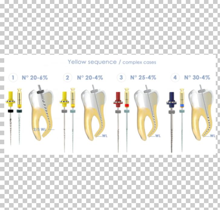 Nickel Titanium Rotary File Surfboard Shaper Tooth Dentist Root Canal PNG, Clipart, Dental Implant, Dentist, Dentistry, Endodontic Files And Reamers, Endodontics Free PNG Download