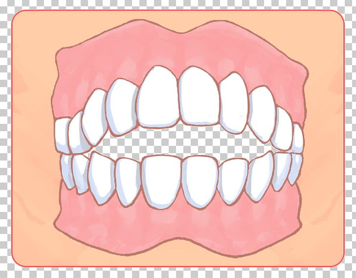 矯正歯科 Dental Braces Dentist Dentition Therapy PNG, Clipart, Cheek, Chin, Cosmetic Dentistry, Dental Braces, Dental Extraction Free PNG Download