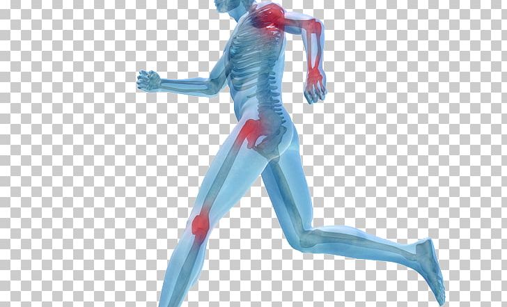 Human Body Joint Pain Knee Pain Platelet-rich Plasma PNG, Clipart, Arm, Arthritis, Back Pain, Fictional Character, Figurine Free PNG Download