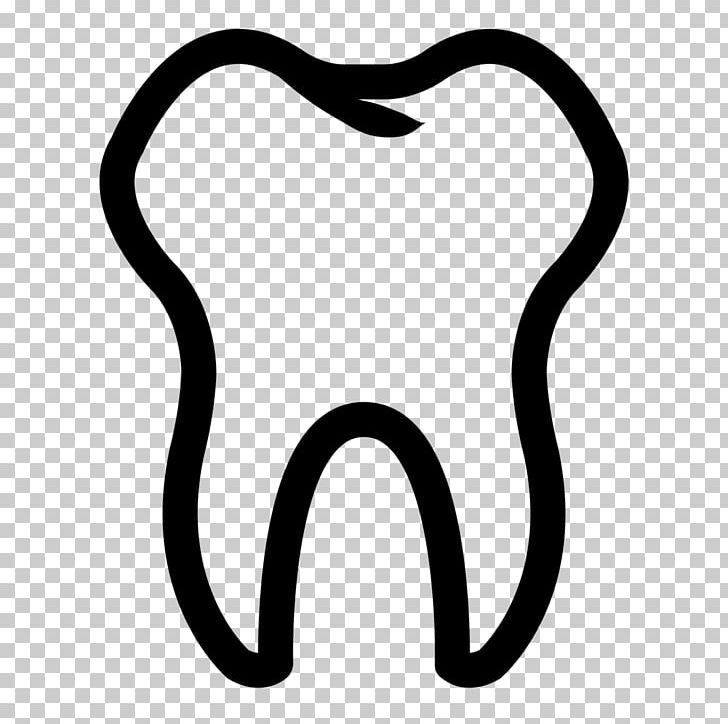 Dentistry Dental Implant Tooth Dental Extraction PNG, Clipart, Black And White, Body Jewelry, Crown, Dental Implant, Dentist Free PNG Download