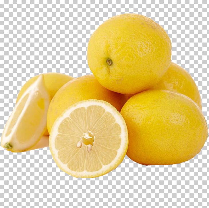 Lemon Juice Squash Food PNG, Clipart, Acne, Bacteria, Business, Citric Acid, Citron Free PNG Download