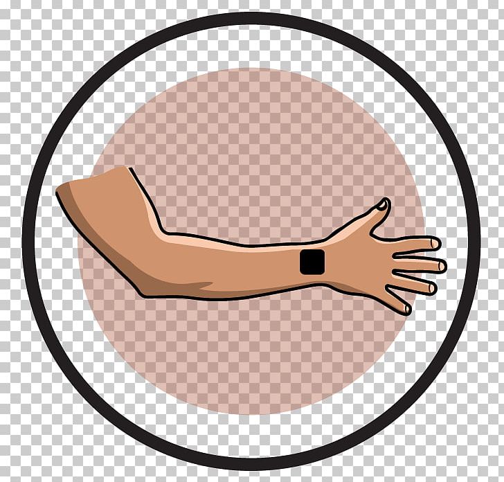 Transcutaneous Electrical Nerve Stimulation Thumb Carpal Tunnel Syndrome Therapy Wrist PNG, Clipart, Arm, Carpal Bones, Carpal Tunnel, Carpal Tunnel Syndrome, Circle Free PNG Download