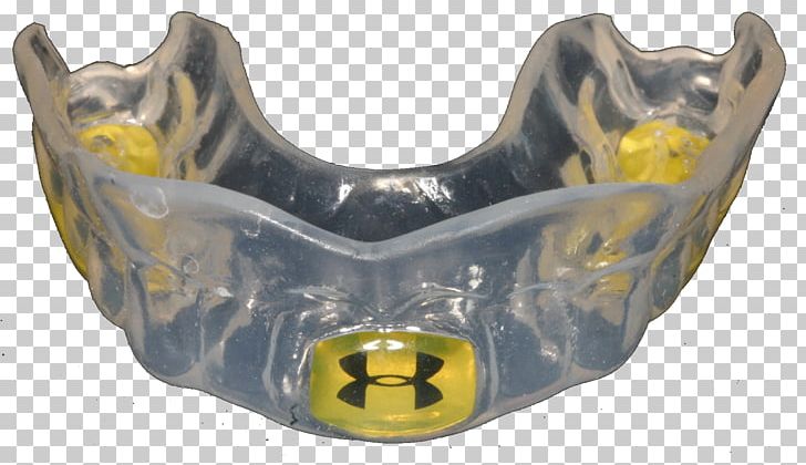 Mouthguard Dentistry Govan Dental Care Temporomandibular Joint Dysfunction PNG, Clipart, American Football, Auto Part, Bridge, Dentist, Dentistry Free PNG Download