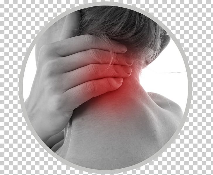 Neck Pain Neck And Shoulder Pain Smesman / Jeroen Headache PNG, Clipart, Chin, Chiropractic, Face, Forehead, Head Free PNG Download