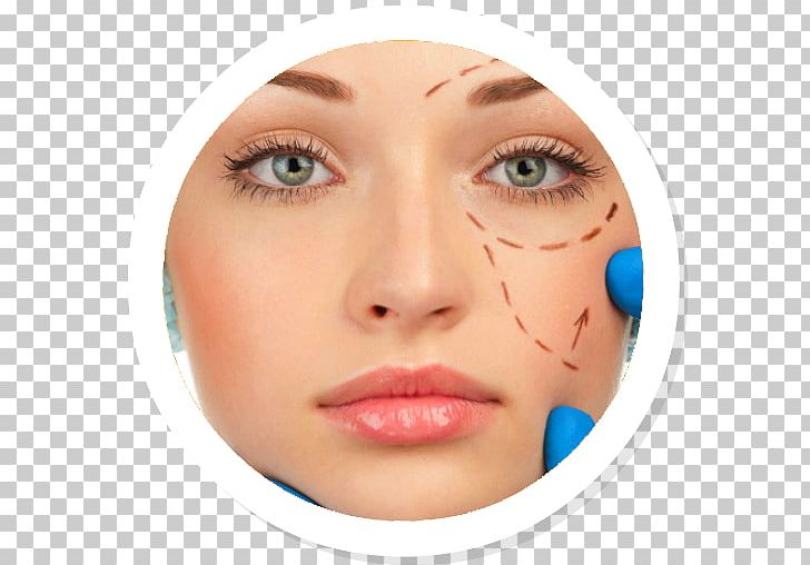 Plastic Surgery Chirurgia Estetica Face Cheek PNG, Clipart, Beauty, Blepharoplasty, Cheek, Chin, Chirurgia Estetica Free PNG Download