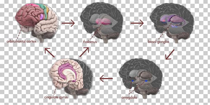 Obsessive–compulsive Disorder Brain Scrupulosity Compulsive Behavior Amygdala PNG, Clipart, Amygdala, Basal Ganglia, Brain, Compulsive Behavior, Disorder Free PNG Download