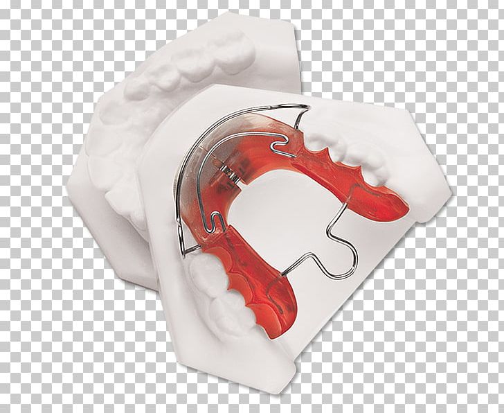Bionator Mandible Orthodontics Tooth Jaw PNG, Clipart, Bionator, Dental Laboratory, Dentistry, Ear, Jaw Free PNG Download
