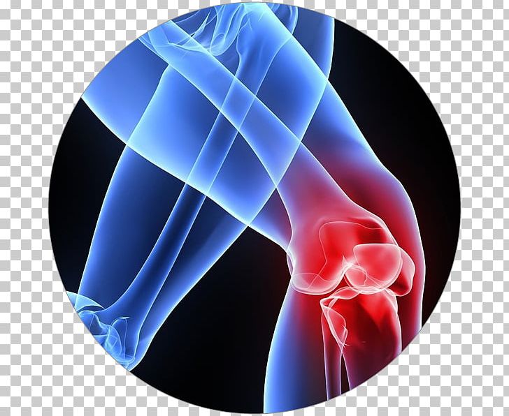 Patellar Tendinitis Tendinopathy Knee Pain PNG, Clipart, Electric Blue, Inflammation, Injury, Joint, Knee Free PNG Download