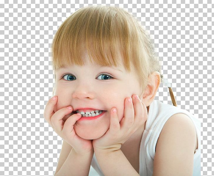 Child Cosmetic Dentistry Health PNG, Clipart, Cheek, Child, Children, Chin, Cleft Lip And Cleft Palate Free PNG Download