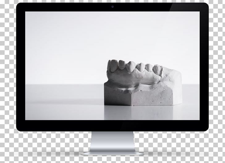 Computer Monitors IMac Cosmetic Dentistry Veneer Tooth Whitening PNG, Clipart, Aesthetics, Brand, Computer Monitor, Computer Monitors, Cosmetic Dentistry Free PNG Download