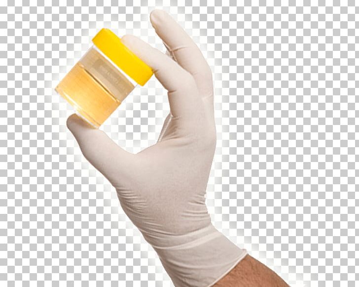Thumb United States Vetoxa Records PNG, Clipart, Arm, Clinical Urine Tests, Drug Withdrawal, Finger, Glove Free PNG Download