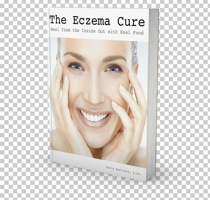 The Eczema Cure Emily Bartlett Cosmetics Healing PNG, Clipart, Beauty, Blond, Cheek, Chin, Cosmetics Free PNG Download