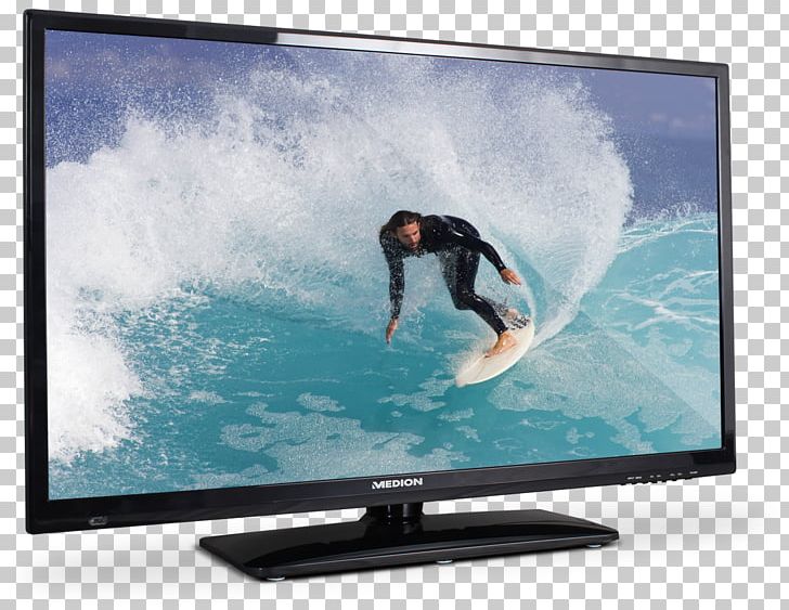 LED-backlit LCD High-definition Television Backlight MEDION LIFE P15180 MEDION LIFE P15494 PNG, Clipart, 720p, Backlight, Computer Monitor, Computer Monitor Accessory, Display Advertising Free PNG Download