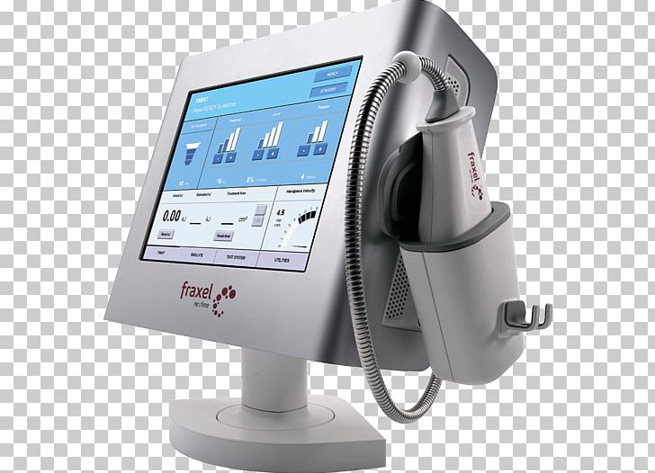 UMETEX Aesthetics Fraxel Laser Aesthetic Medicine PNG, Clipart, Aesthetic, Aesthetics, Computer Monitor Accessory, Display Device, Electronics Free PNG Download