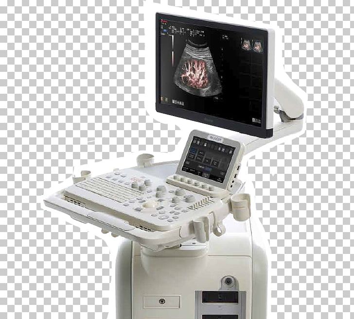 Medical Equipment Ultrasonography Ultrasound Esaote Ecógrafo PNG, Clipart, Electronics, Esaote, Information, Magnetic Resonance Imaging, Medical Free PNG Download