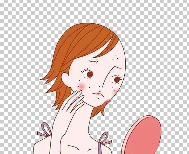Acne Face Puberty Skin Rosacea PNG, Clipart, Adult, Arm, Boy, Business Woman, Cartoon Free PNG Download