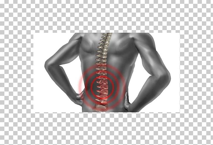 Back Pain Physical Therapy Vertebral Column Acupuncture Human Back PNG, Clipart, Abdomen, Active Undergarment, Acupuncture, Arm, Back Free PNG Download