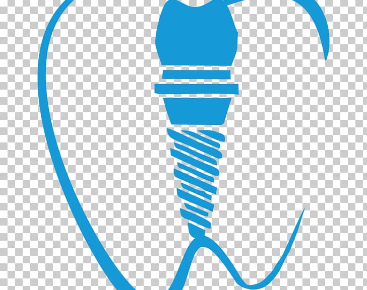 Tooth Dental Implant Dentistry PNG, Clipart, Area, Circle, Computed Tomography, Dental Implant, Dentist Free PNG Download