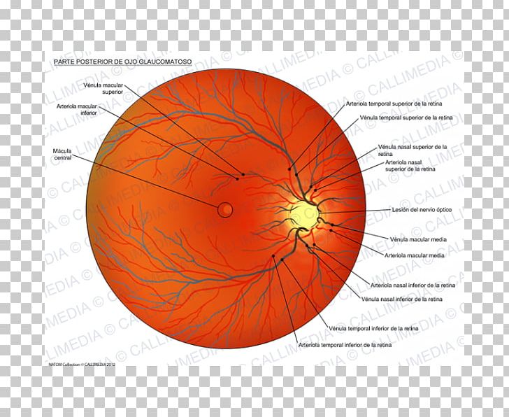 Dilated Fundus Examination Eye Glaucoma Esame Del Fondo Oculare PNG, Clipart, Arthritis, Astigmatism, Banco De Imagens, Circle, Dilated Fundus Examination Free PNG Download