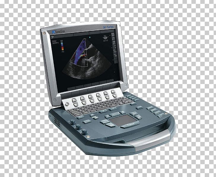 SonoSite PNG, Clipart, Doppler Echocardiography, Electronic Device, Electronics, Input Device, Laptop Free PNG Download
