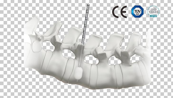 Orthopedic Surgery Medicine Vertebral Column PNG, Clipart, Angle, Business, Ceres, Cervical Vertebrae, Implant Free PNG Download