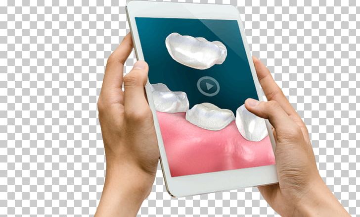Dentistry Patient Education Patient Education PNG, Clipart, Communication Device, Continuing Education, Course, Dds, Dental Free PNG Download