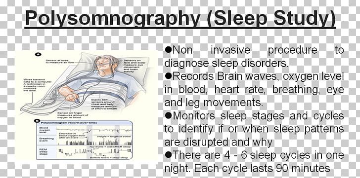 Polysomnography Sleep Study Sleep Disorder Sleep Apnea PNG, Clipart, Angle, Area, Breathing, Diagnostic Test, Diagram Free PNG Download