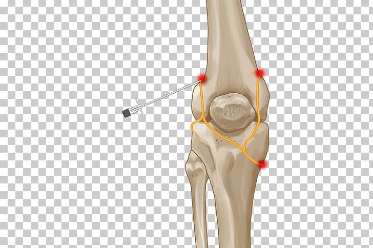Thumb Knee Pain Joint Nerve PNG, Clipart, Arm, Bone, Disease, Elbow, Femoral Nerve Free PNG Download
