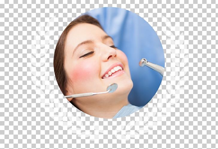 Cosmetic Dentistry Dental Surgery Restorative Dentistry PNG, Clipart, Cheek, Chin, Cosmetic Dentistry, Dental, Dental Implant Free PNG Download