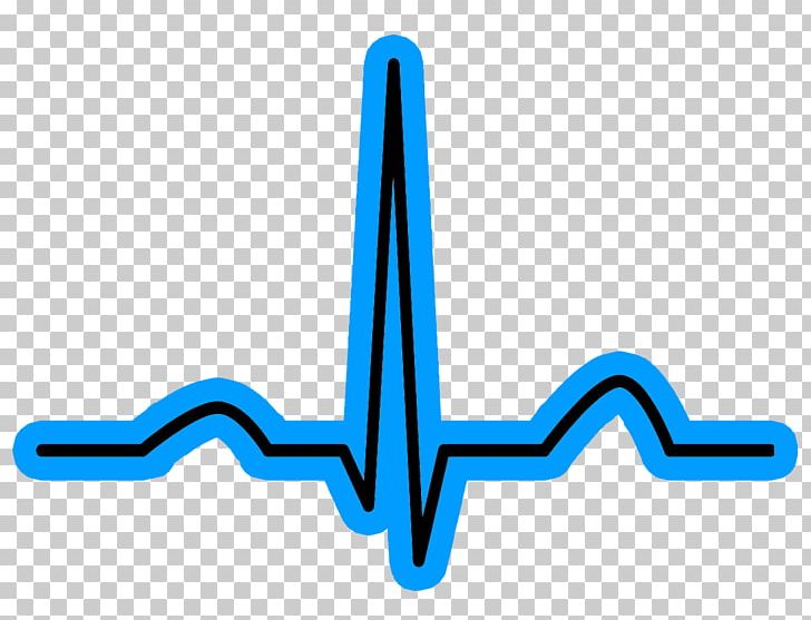 Sinus Rhythm Music Training Heart Arrhythmia PNG, Clipart, Angle, Artificial Cardiac Pacemaker, Atrial Fibrillation, Atrial Flutter, Atrium Free PNG Download