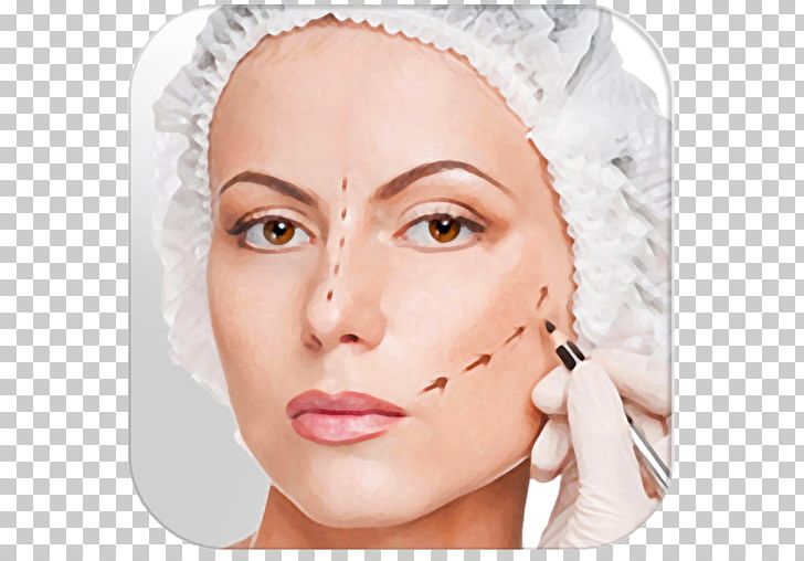 Plastic Surgery Aesthetic Medicine Blepharoplasty PNG, Clipart, Aesthetic Medicine, Beauty, Blepharoplasty, Cheek, Chin Free PNG Download