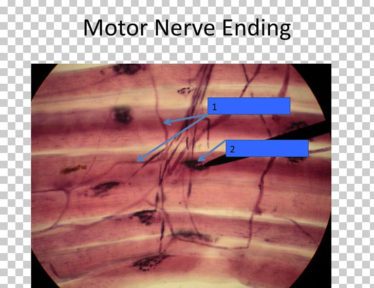 Motor Nerve Free Nerve Ending Nervous System Nervous Tissue Axon Terminal PNG, Clipart, Anatomy, Angle, Arm, Axon, Axon Terminal Free PNG Download