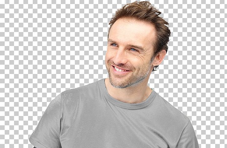 Hair Transplantation Follicular Unit Extraction Hair Loss Surgery PNG, Clipart, Capelli, Chin, Facial Hair, Follicular Unit Extraction, Forehead Free PNG Download