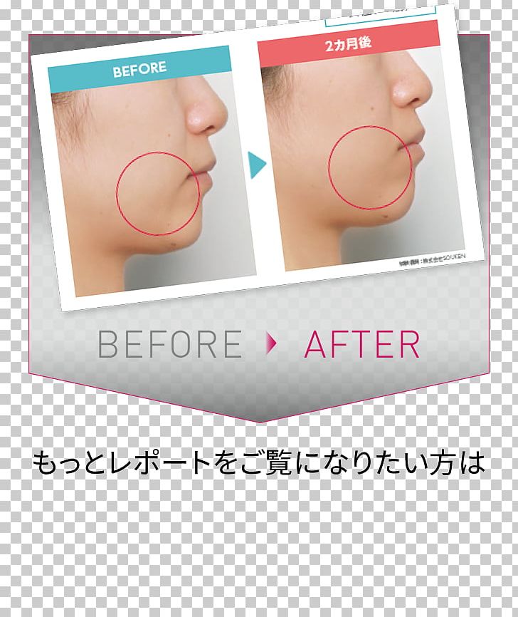 Face Physical Fitness Skin Exercise Naver Blog PNG, Clipart, Ear, Exercise, Face, Japan, Joint Free PNG Download